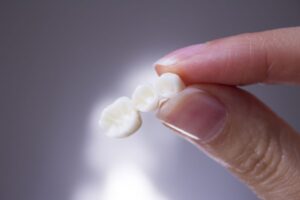 ホワイトニング以外で差し歯を白くする方法はある？