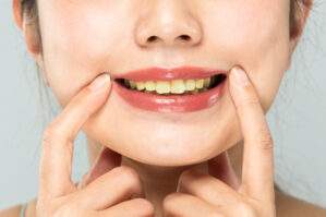 歯が汚れる原因とおすすめの対策