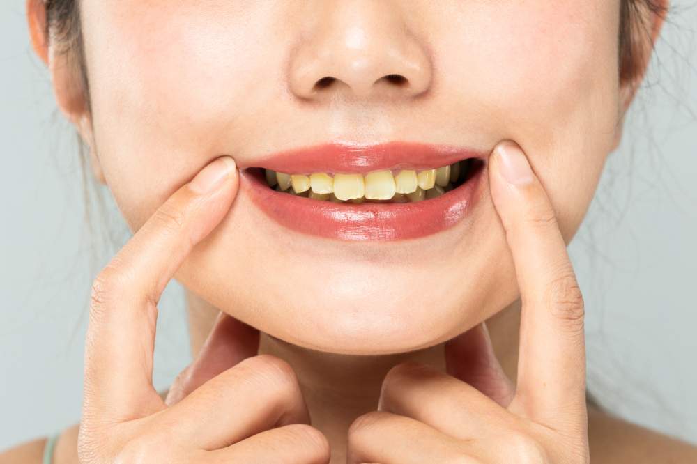 汚い歯を綺麗にしたい!歯が汚れる原因や対策・対処法を解説 【公式】ホワイトニングバー 汚い歯を綺麗にしたい!歯が汚れる原因や対策・対処法を解説 【公式】ホワイトニングバー