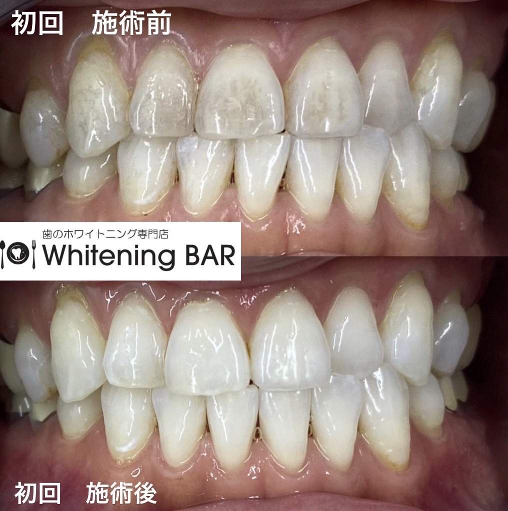 症例 2023-02-13-12.24.45